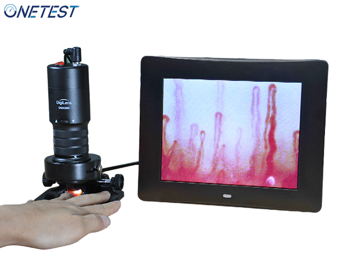 微循環(huán)血液檢測儀特點(diǎn)與應(yīng)用是哪些