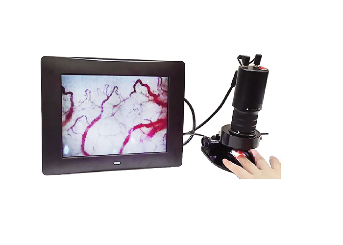 微循環(huán)血液檢測儀特點(diǎn)與應(yīng)用是哪些